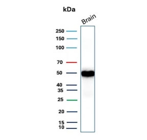Western blot testing of human brain tissue lysate with recombinant GFAP antibody (clone rGFAP/9150). Predicted molecular weight ~50 kDa.