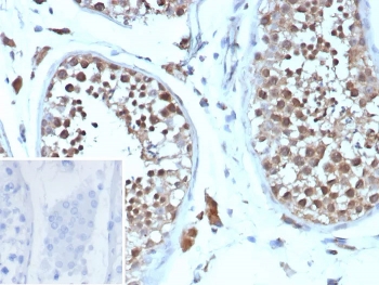 IHC staining of FFPE human testis tissue with recombinant Cyclin B1 antibody (clone CCNB1/9242R). Inset: PBS used in place of primary Ab (secondary Ab negative control). HIER: boil tissue sections in pH 9 10mM Tris with 1mM EDTA for 20 min and allow to cool before testing.