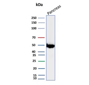 Western blot testing of human pancreas tissue lysate with PNLIP antibody. Predicted molecular weight ~51 kDa.
