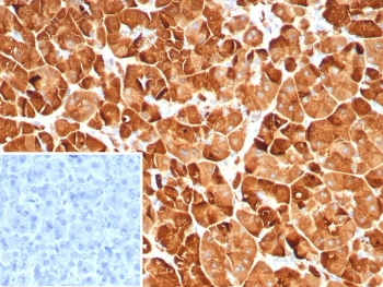 IHC staining of FFPE human pancreas tissue with Pancreatic lipase antibody (clone PNLIP/9039). Inset: PBS used in place of primary Ab (secondary Ab negative control). HIER: boil tissue sections in pH 9 10mM Tris with 1mM EDTA for 20 min and allow to cool before testing.