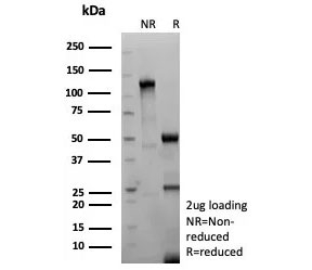 SDS-PAGE analysis of purified recombinant TSHR beta antibody (clone TSHRB/9215R) as confirmation of integrity and purity.