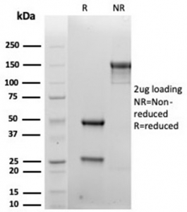 SDS-PAGE analysis of purified, BSA-free recombinant SDC1 antibody (clone rSDC1/6866) as confirmation of integrity and purity.