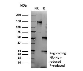 SDS-PAGE analysis of purified, BSA-free recombinant CD95 antibody (clone FAS/9322R) as confirmation of integrity and purity.
