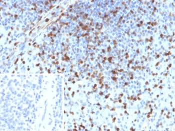 IHC staining of FFPE human spleen tissue with S100A4 antibody (clone S100A4/6796). Inset: PBS used in place of primary Ab (secondary Ab negative control). HIER: boil tissue sections in pH 9 10mM Tris with 1mM EDTA for 20 min and allow to cool before testing.