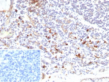 IHC staining of FFPE human tonsil tissue with recombinant IL3RA antibody (clone rIL3RA/9212). Inset: PBS used in place of primary Ab (secondary Ab negative control). HIER: boil tissue sections in pH 9 10mM Tris with 1mM EDTA for 20 min and allow to cool before testing.