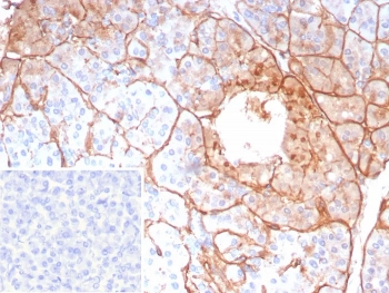 IHC staining of FFPE human pancreas tissue with COL4A5 antibody (clone COL4A5/9396R). Inset: PBS used in place of primary Ab (secondary Ab negative control). HIER: boil tissue sections in pH 9 10mM Tris with 1mM EDTA for 20 min and allow to cool before testing.