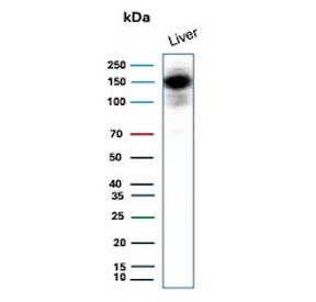 Western blot testing of human liver tissue lysate with recombinant Carbamoyl phosphate synthetase 1 antibody. Predicted molecular weight ~165 kDa.