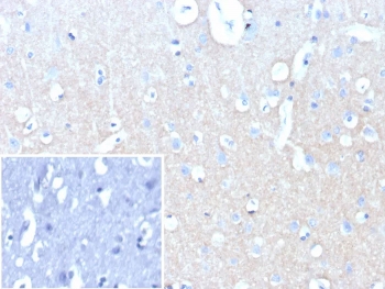 IHC staining of FFPE human brain tissue with recombinant NCAM-L1 antibody (clone L1CAM/9146R). Inset: PBS used in place of primary Ab (secondary Ab negative control). HIER: boil tissue sections in pH 9 10mM Tris with 1mM EDTA for 20 min and allow to cool before testing.