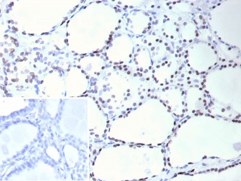 IHC staining of FFPE human thyroid tissue with Thyroid transcription factor 1 antibody (clone NX2.1/9036). Inset: PBS used in place of primary Ab (secondary Ab negative control). HIER: boil tissue sections in pH 9 10mM Tris with 1mM EDTA for 20 min and allow to cool before testing.