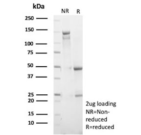 SDS-PAGE analysis of purified, BSA-free recombinant MKI67 antibody (clone rMKI67/9616) as confirmation of integrity and purity.