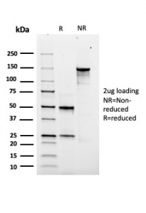 SDS-PAGE analysis of purified, BSA-free recombinant SOX9 antibody (clone rSOX9/2288) as confirmation of integrity and purity.