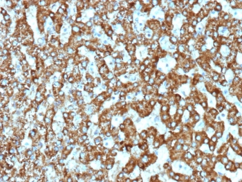 IHC staining of FFPE human liver tissue with recombinant EPH Receptor B4 antibody (clone EPHB4/9663R). HIER: boil tissue sections in pH 9 10mM Tris with 1mM EDTA for 20 min and allow to cool before testing.