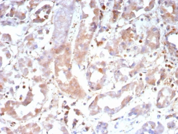 IHC staining of FFPE human kidney tissue with Caspase 7 antibody (clone CASP7/9052). HIER: boil tissue sections in pH 9 10mM Tris with 1mM EDTA for 20 min and allow to cool before testing.