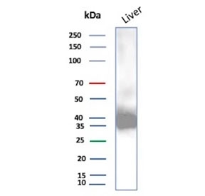Western blot testing of human liver tissue lysate using AKR1C1 antibody (clone AKR1C1/9070). Predicted molecular weight ~37 kDa.