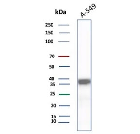 Western blot testing of human A549 cell lysate using AKR1C1 antibody (clone AKR1C1/9317). Predicted molecular weight ~37 kDa.