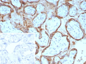 IHC staining of FFPE human placental tissue with Epstein-Barr virus induced 3 antibody (clone EBI3/8904). Inset: PBS used in place of primary Ab (secondary Ab negative control). HIER: boil tissue sections in pH 9 10mM Tris with 1mM EDTA for 20 min and allow to cool before testing.