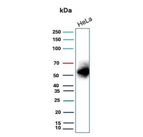 Western blot testing of human HeLa cell lysate with recombinant Carbonic Anhydrase IX antibody. Predicted molecular weight: 50-55 kDa but may be observed at higher molecular weights due to glycosylation.