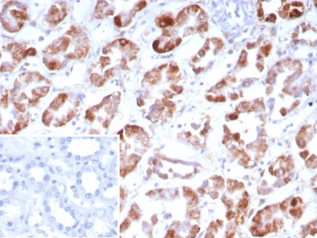 IHC staining of FFPE human kidney tissue with Fibroblast Growth Factor 23 antibody (clone FGF23/9059). Inset: PBS used in place of primary Ab (secondary Ab negative control). HIER: boil tissue sections in pH 9 10mM Tris with 1mM EDTA for 20 min and allow to cool before testing.