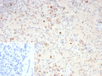 IHC staining of FFPE human spleen tissue with Resistin antibody (clone RETN/4325). Inset: PBS used in place of primary Ab (secondary Ab negative control). HIER: boil tissue sections in pH 9 10mM Tris with 1mM EDTA for 20 min and allow to cool before testing.