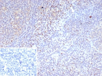 IHC staining of FFPE human tonsil tissue with recombinant LEF1 antibody (clone LEF1/9403R). Strong nuclear staining of non-germinal center of cells observed. Inset: PBS used in place of primary Ab (secondary Ab negative control). HIER: boil tissue sections in pH 9 10mM Tris with 1mM EDTA for 20 min and allow to cool before testing.