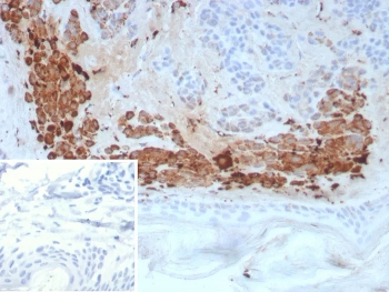 IHC staining of FFPE human skin tissue with KLK4 antibody (clone KLK4/8941). HIER: boil tissue sections in pH 9 10mM Tris with 1mM EDTA for 20 min and allow to cool before testing.