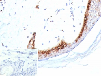 IHC staining of FFPE human skin tissue with Kallikrein 4 antibody (clone KLK4/8942). HIER: boil tissue sections in pH 9 10mM Tris with 1mM EDTA for 20 min and allow to cool before testing.