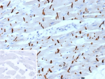 IHC staining of FFPE human heart tissue with Cadherin 2 antibody (clone CDH2/9488). Inset: PBS used in place of primary Ab (secondary Ab negative control). HIER: boil tissue sections in pH 9 10mM Tris with 1mM EDTA for 20 min and allow to cool before testing.