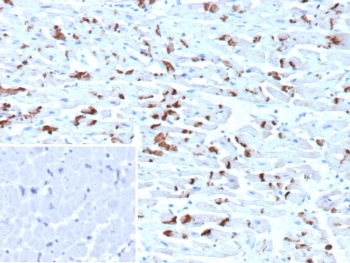IHC staining of FFPE human heart tissue with CDH2 antibody (clone CDH2/9492). Inset: PBS used in place of primary Ab (secondary Ab negative control). HIER: boil tissue sections in pH 9 10mM Tris with 1mM EDTA for 20 min and allow to cool before testing.