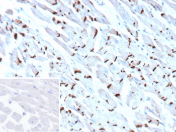 IHC staining of FFPE human heart tissue with Cadherin 2 antibody (clone CDH2/9493). Inset: PBS used in place of primary Ab (secondary Ab negative control). HIER: boil tissue sections in pH 9 10mM Tris with 1mM EDTA for 20 min and allow to cool before testing.