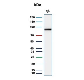 Western blot testing of human small intestine tissue lysate with Cadherin 17 antibody (clone CDH17/2612). Predicted molecular weight ~92 kDa but may be observed at higher molecular weights due to glycosylation.