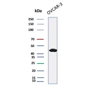 Western blot testing of human OVCAR-3 cell lysate with Mesothelin antibody (clone MSLN/2132). Predicted molecular weight ~69 kDa (precursor), ~40 kDa (cleaved form). Glycosylation may make the protein run higher than expected.
