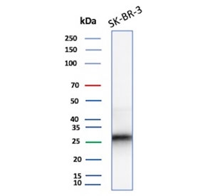 Western blot testing of human SK-BR-3 cell lysate with recombinant CDKN1B antibody (clone rCDKN1B/13245). Commonly observed at ~27 kDa.