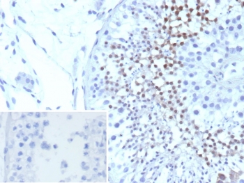 IHC staining of FFPE human testis tissue with Centrin 1 antibody (clone CETN1/9880). Inset: PBS used in place of primary Ab (secondary Ab negative control). HIER: boil tissue sections in pH 9 10mM Tris with 1mM EDTA for 20 min and allow to cool before testing.