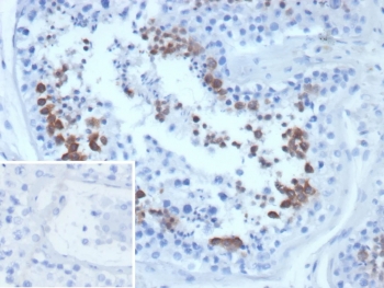 IHC staining of FFPE human testis tissue with CEN1 antibody (clone CETN1/9877). Inset: PBS used in place of primary Ab (secondary Ab negative control). HIER: boil tissue sections in pH 9 10mM Tris with 1mM EDTA for 20 min and allow to cool before testing.
