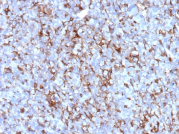 IHC staining of FFPE human adrenal gland tissue with Clusterin antibody (clone CLU/12058). HIER: boil tissue sections in pH 9 10mM Tris with 1mM EDTA for 20 min and allow to cool before testing.
