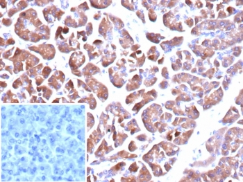 IHC staining of FFPE human pancreas tissue with CLPS antibody (clone CLPS/9898). Inset: PBS used in place of primary Ab (secondary Ab negative control). HIER: boil tissue sections in pH 9 10mM Tris with 1mM EDTA for 20 min and allow to cool before testing.