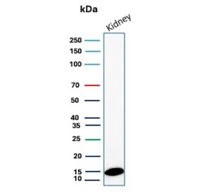 Western blot testing of human kidney tissue lysate with FABP1 antibody (clone FABP1/4518). Predicted molecular weight ~15 kDa.