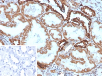 IHC staining of FFPE human kidney tissue with Secretory phospholipase A2 receptor antibody (clone PLA2R1/4896). Inset: PBS used in place of primary Ab (secondary Ab negative control). HIER: boil tissue sections in pH 9 10mM Tris with 1mM EDTA for 20 min and allow to cool before testing.