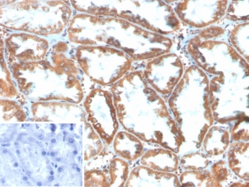 IHC staining of FFPE human kidney tissue with Phospholipase A2 Receptor 1 antibody (clone PLA2R1/4897). Inset: PBS used in place of primary Ab (secondary Ab negative control). HIER: boil tissue sections in pH 9 10mM Tris with 1mM EDTA for 20 min and allow to cool before testing.