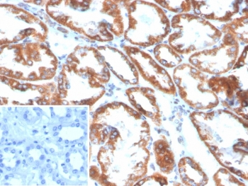 IHC staining of FFPE human kidney tissue with Phospholipase A2 Receptor 1 antibody (clone PLA2R1/4898). Inset: PBS used in place of primary Ab (secondary Ab negative control). HIER: boil tissue sections in pH 9 10mM Tris with 1mM EDTA for 20 min and allow to cool before testing.