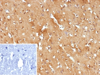 IHC staining of FFPE human brain tissue with Fms-like tyrosine kinase 3 antibody (clone FLT3/9886). Inset: PBS used in place of primary Ab (secondary Ab negative control). HIER: boil tissue sections in pH 9 10mM Tris with 1mM EDTA for 20 min and allow to cool before testing.