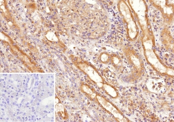 IHC staining of FFPE human kidney tissue with Fms-like tyrosine kinase 3 antibody (clone FLT3/9886). Inset: PBS used in place of primary Ab (secondary Ab negative control). HIER: boil tissue sections in pH 9 10mM Tris with 1mM EDTA for 20 min and allow to cool before testing.