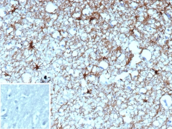 IHC staining of FFPE human brain tissue with GFAP antibody (clone GFAP/9420). Inset: PBS used in place of primary Ab (secondary Ab negative control). HIER: boil tissue sections in pH 9 10mM Tris with 1mM EDTA for 20 min and allow to cool before testing.