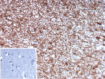 IHC staining of FFPE human brain tissue with GFAP antibody (clone GFAP/9422). Inset: PBS used in place of primary Ab (secondary Ab negative control). HIER: boil tissue sections in pH 9 10mM Tris with 1mM EDTA for 20 min and allow to cool before testing.