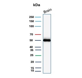 Western blot testing of human brain tissue with GFAP antibody (clone GFAP/9423). Predicted molecular weight ~50 kDa.