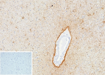 IHC staining of FFPE human brain tissue with GFAP antibody (clone GFAP/9424). Inset: PBS used in place of primary Ab (secondary Ab negative control). HIER: boil tissue sections in pH 9 10mM Tris with 1mM EDTA for 20 min and allow to cool before testing.