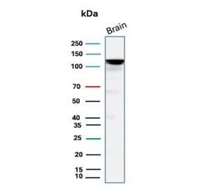 Western blot testing of human brain tissue lysate with Hexokinase 1 antibody (clone HK1/9504). Predicted molecular weight ~120 kDa.