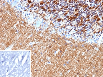 IHC staining of FFPE human brain tissue with Hexokinase 1 antibody (clone HK1/9514). Inset: PBS used in place of primary Ab (secondary Ab negative control). HIER: boil tissue sections in pH 9 10mM Tris with 1mM EDTA for 20 min and allow to cool before testing.