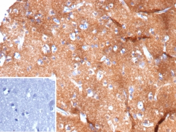 IHC staining of FFPE human brain tissue with HK1 antibody (clone HK1/9508). Inset: PBS used in place of primary Ab (secondary Ab negative control). HIER: boil tissue sections in pH 9 10mM Tris with 1mM EDTA for 20 min and allow to cool before testing.