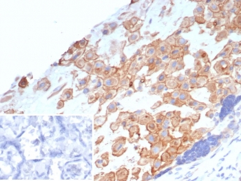 IHC staining of FFPE human placental tissue with MHC class I antigen G antibody (clone HLAG/7749). Inset: PBS used in place of primary Ab (secondary Ab negative control). HIER: boil tissue sections in pH 9 10mM Tris with 1mM EDTA for 20 min and allow to cool before testing.